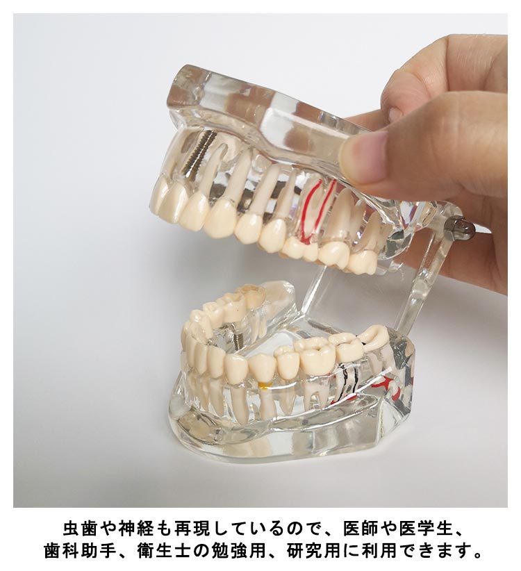 歯科器具　教材