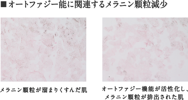 オートファジー能に関連するメラニン顆粒減少ーメラニン顆粒が溜まりくすんだ肌（左）オートファジー機能が活性化し、メラニン顆粒が排出された肌（右）