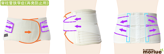 脊柱管狭窄症の腰痛ベルト/イオンクールコルセット/全体図