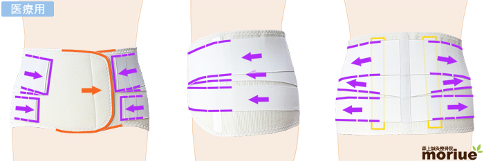医療用の腰痛ベルト/ハードガード・ソフト/全体図