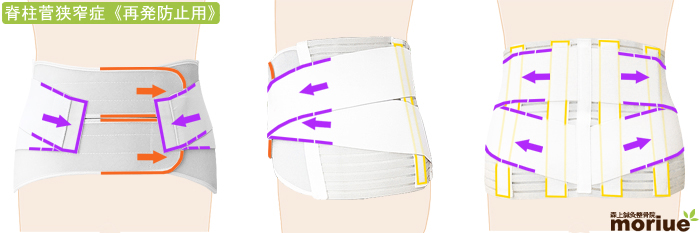 脊柱管狭窄症用腰痛ベルト/ハードデラックス・ソフト/全体図