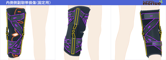 楽天市場 内側側副靭帯 固定用 膝サポーター ニーケアー ｍｃｌ コルセットミュージアム