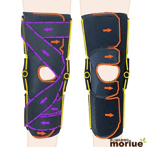内側側副靭帯損傷｜おすすめの膝サポーター