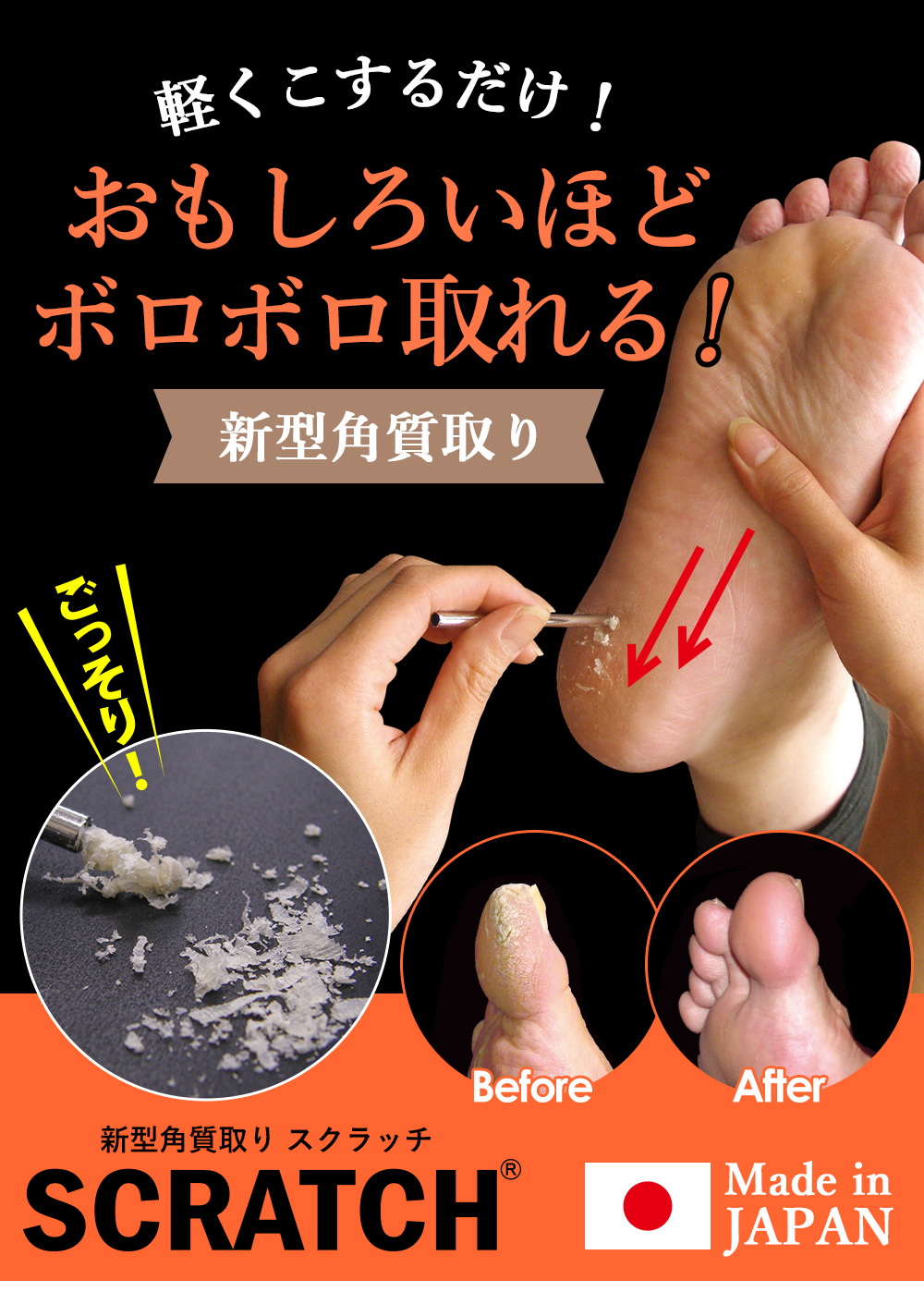 日本最大の 角質取り タコ 魚の目 フットケア 角質ケア かかと スキンケア 美容 角質削り 通販